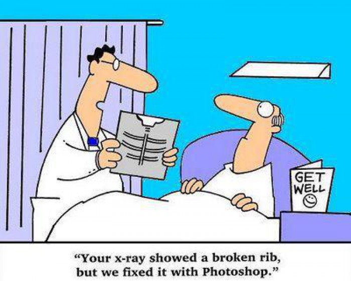 Broken rib